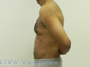 americanlipocenters_199.jpg